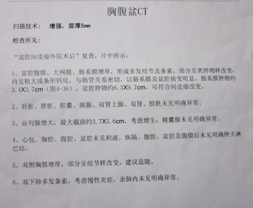 北京各大名肿瘤医院病理分析，结果都不一样。病情发展迅速。请教高人急救！谢谢图3