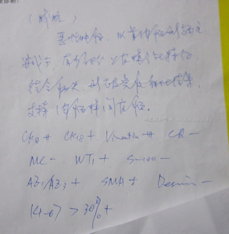 北京各大名肿瘤医院病理分析，结果都不一样。病情发展迅速。请教高人急救！谢谢图5