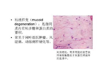 病理学名词图解-3图2