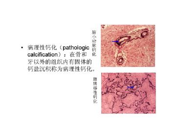 病理学名词图解-3图5