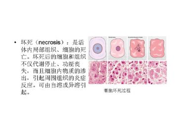 病理学名词图解-3图6