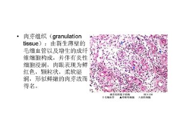 病理学名词图解-3图7