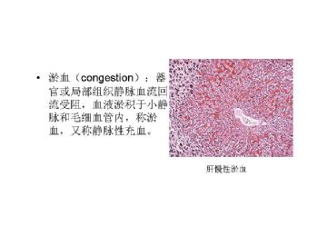 病理学名词图解-3图9