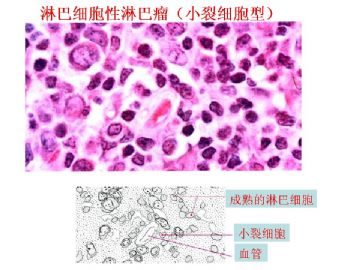 细胞核形态学诊断病理学中的意义图17