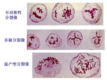 细胞核形态学在诊断病理中的意义（五）图12