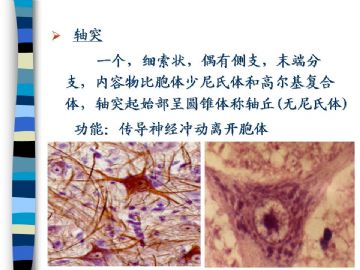 组织胚胎学-神经组织（图片）图10