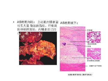 病理学名词图解-5图8