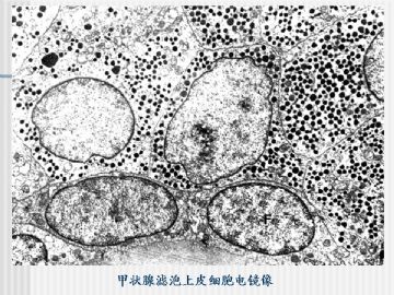 组织胚胎学-内分泌系统（图片）图8