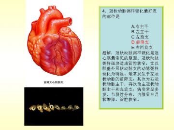 执业医师考试病理真题图解图4