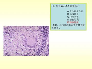 执业医师考试病理真题图解图5