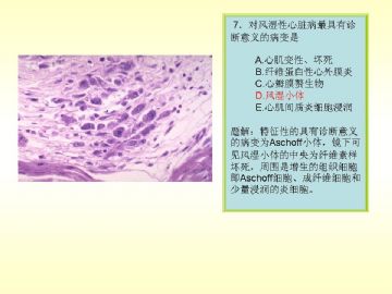 执业医师考试病理真题图解图7