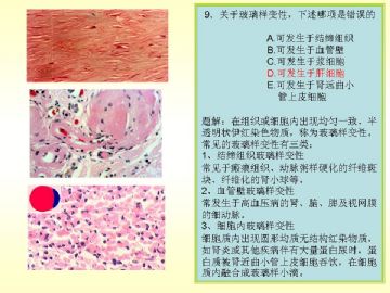 执业医师考试病理真题图解图9