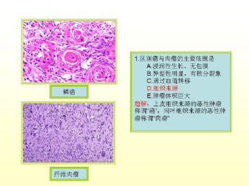 执业医师考试病理真题图解（2）图2