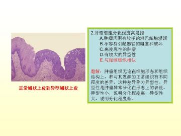 执业医师考试病理真题图解（2）图3