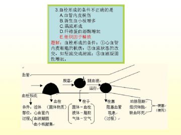 执业医师考试病理真题图解（2）图4