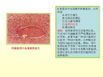 执业医师考试病理真题图解（2）图5