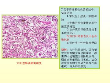 执业医师考试病理真题图解（2）图8