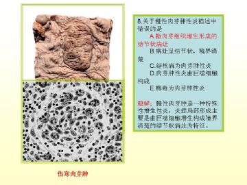 执业医师考试病理真题图解（2）图9