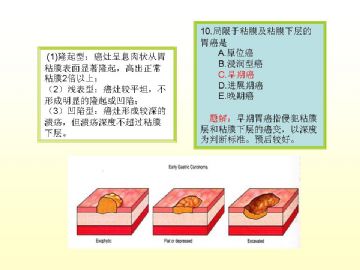 执业医师考试病理真题图解（2）图11