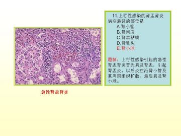 执业医师考试病理真题图解（2）图12