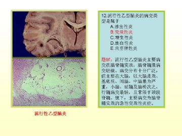 执业医师考试病理真题图解（2）图13