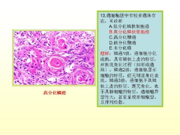 执业医师考试病理真题图解（2）图14