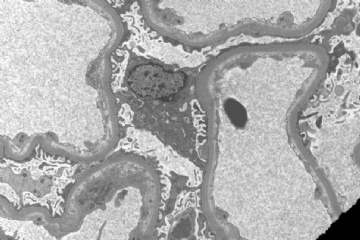 Allograft kidney图2