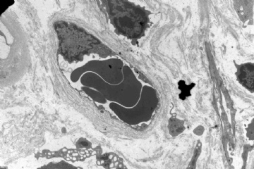 Allograft kidney图6