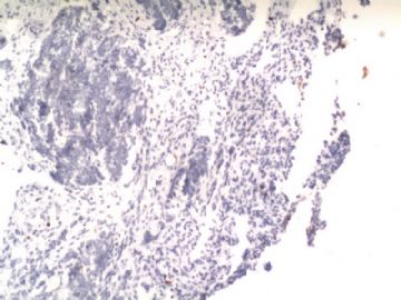 电切子宫内膜息肉标本图11