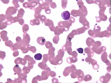血片细胞图2