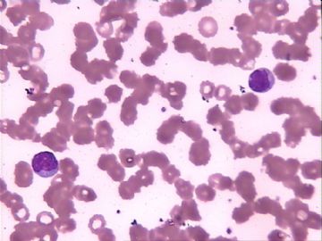 血片细胞图4