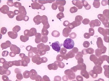 血片细胞图6