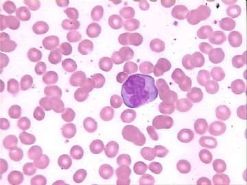 血片细胞图8