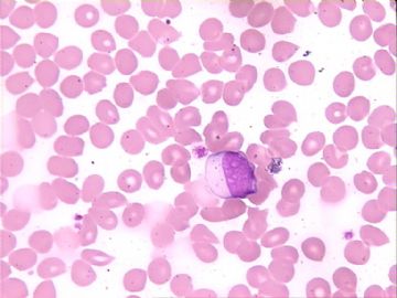 血片细胞图9