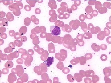 血片细胞图10