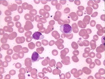 血片细胞图11