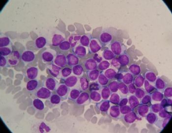 血涂片 中的细胞是那种细胞图1