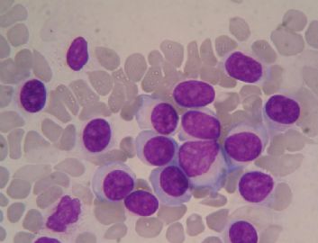 血涂片 中的细胞是那种细胞图5