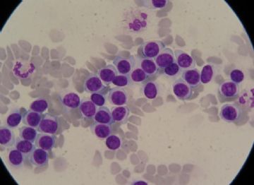 血涂片 中的细胞是那种细胞图6
