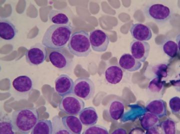 血涂片 中的细胞是那种细胞图7