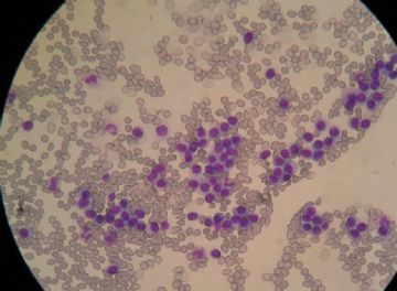 血涂片 中的细胞是那种细胞图8