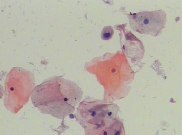 宫颈TCT(11)你们开会我发贴图3