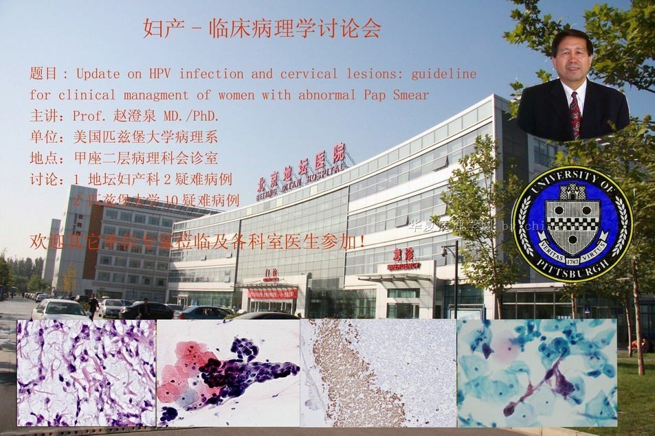 北京地坛医院学术讲座-宫颈HPV感染及宫颈疾病的处理图1