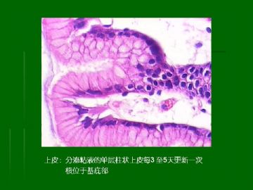 胃粘膜组织学图9