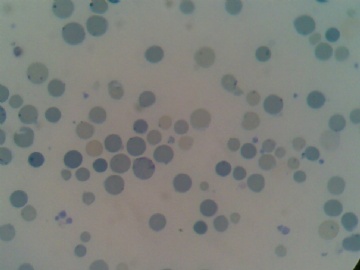 网织红细胞图1