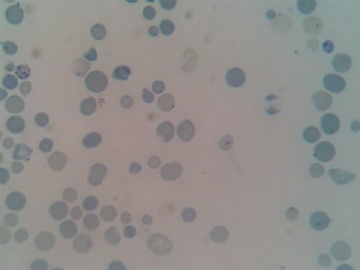 网织红细胞图2