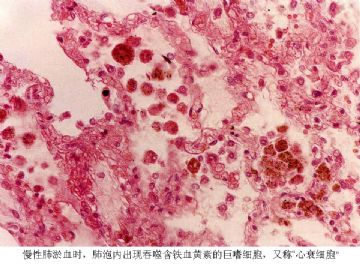 ZT《病理医师问答-2》图8