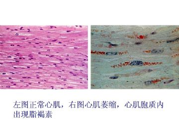 ZT《病理医师问答-2》图10