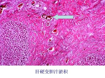 ZT《病理医师问答-2》图11