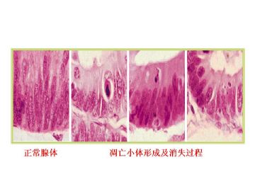 ZT《病理医师问答-3》图3